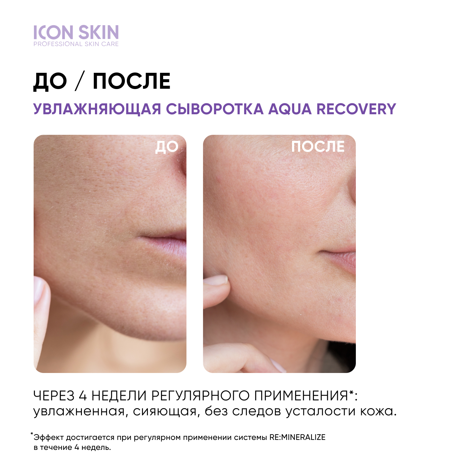 Сыворотка ICON SKIN 30 мл - фото 2