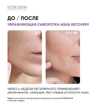 Сыворотка ICON SKIN 30 мл
