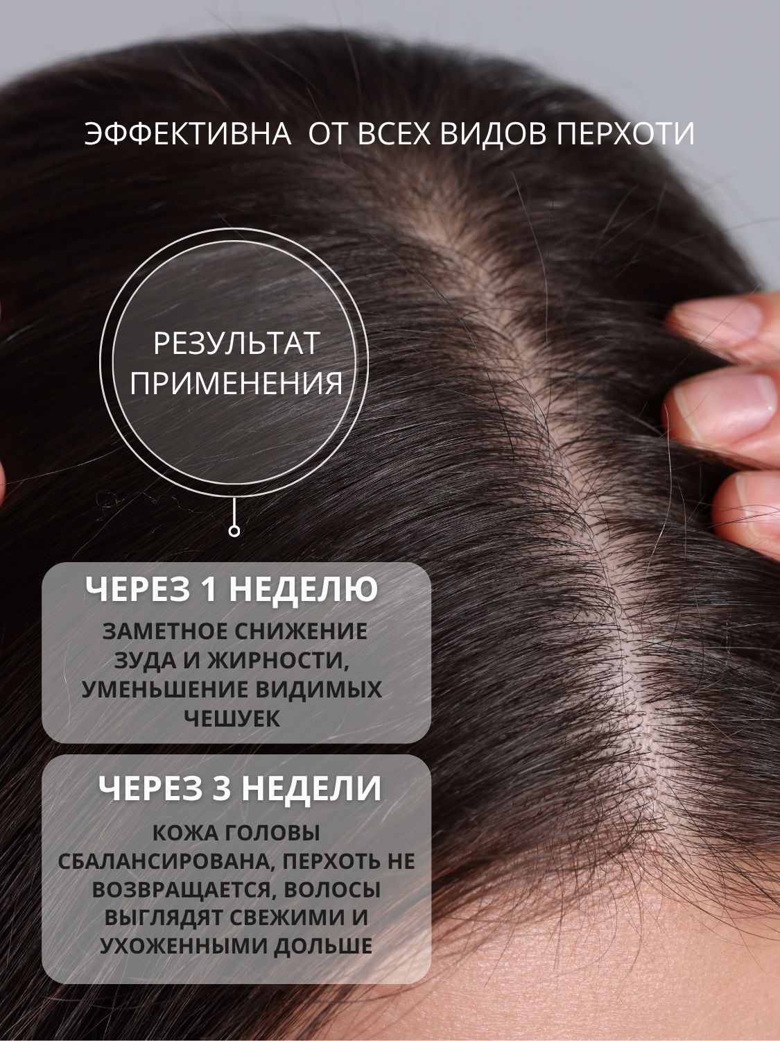 Сыворотка DR. MARCUS HEILER Микробиом баланс от перхоти 100 мл - фото 11