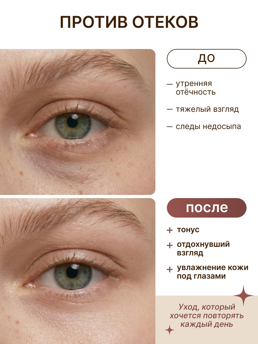 Патчи ELEMENT Отбеливающие - фото 2