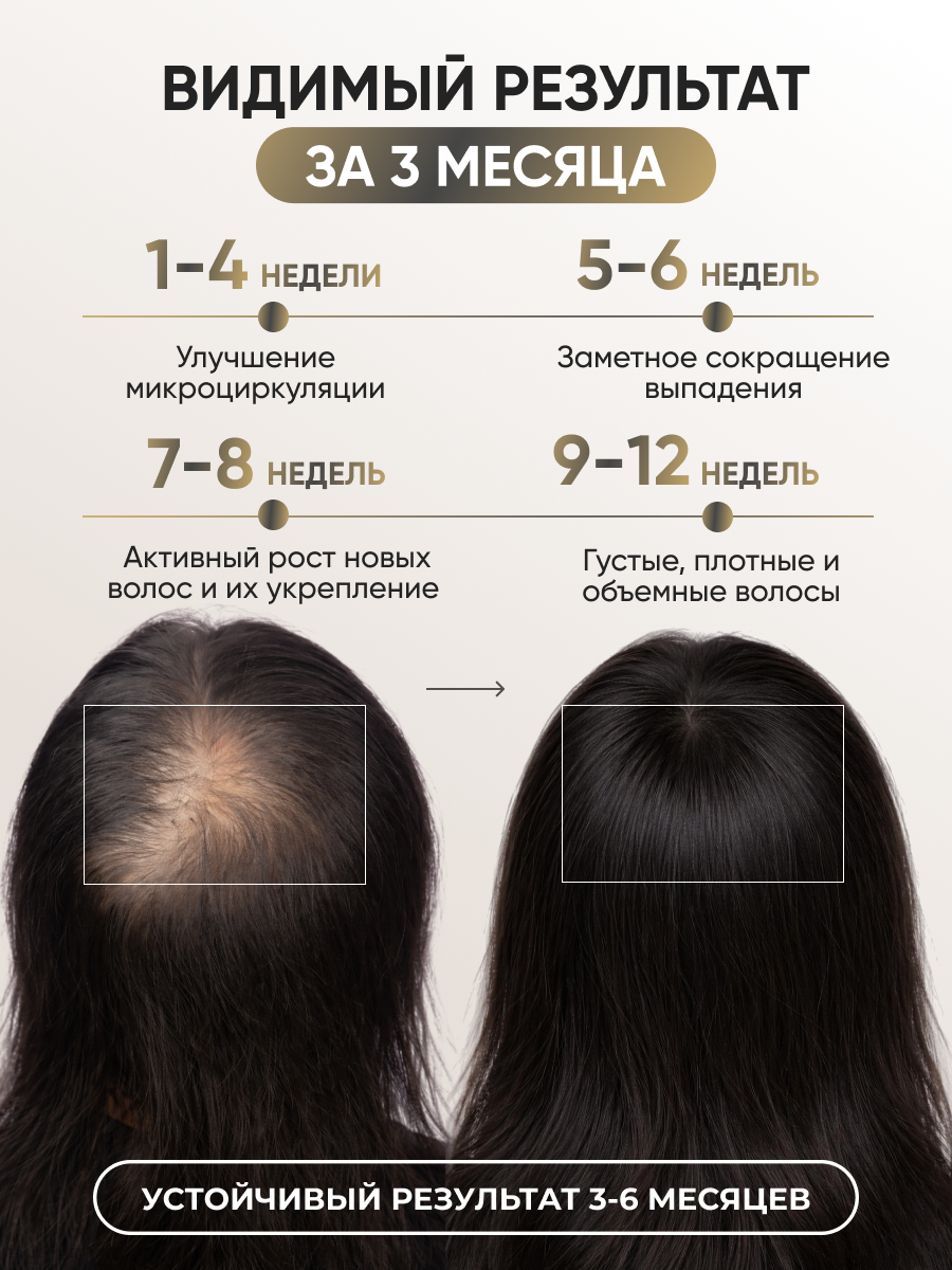Лосьон Ринфолтил 100 мл - фото 3