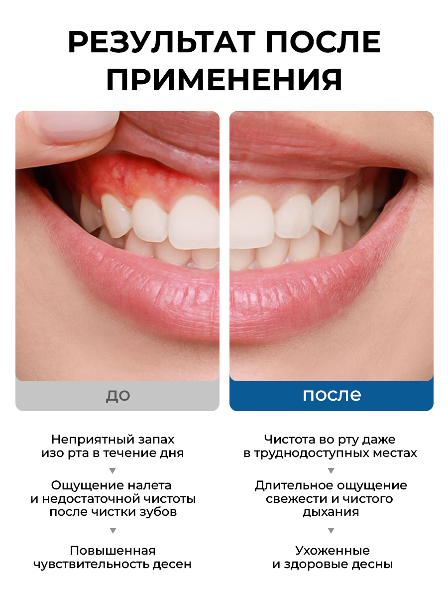 Ополаскиватель STOMATOL Calcium 500 мл - фото 8
