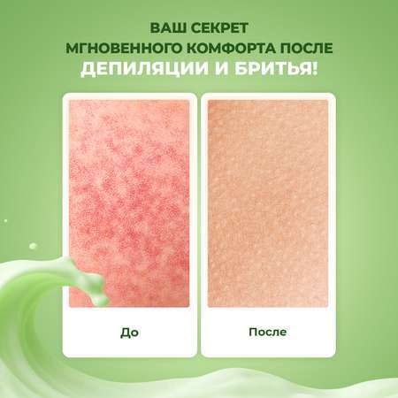 Антигистаминная крем-маска YesMix после депиляции и бритья, 100 мл