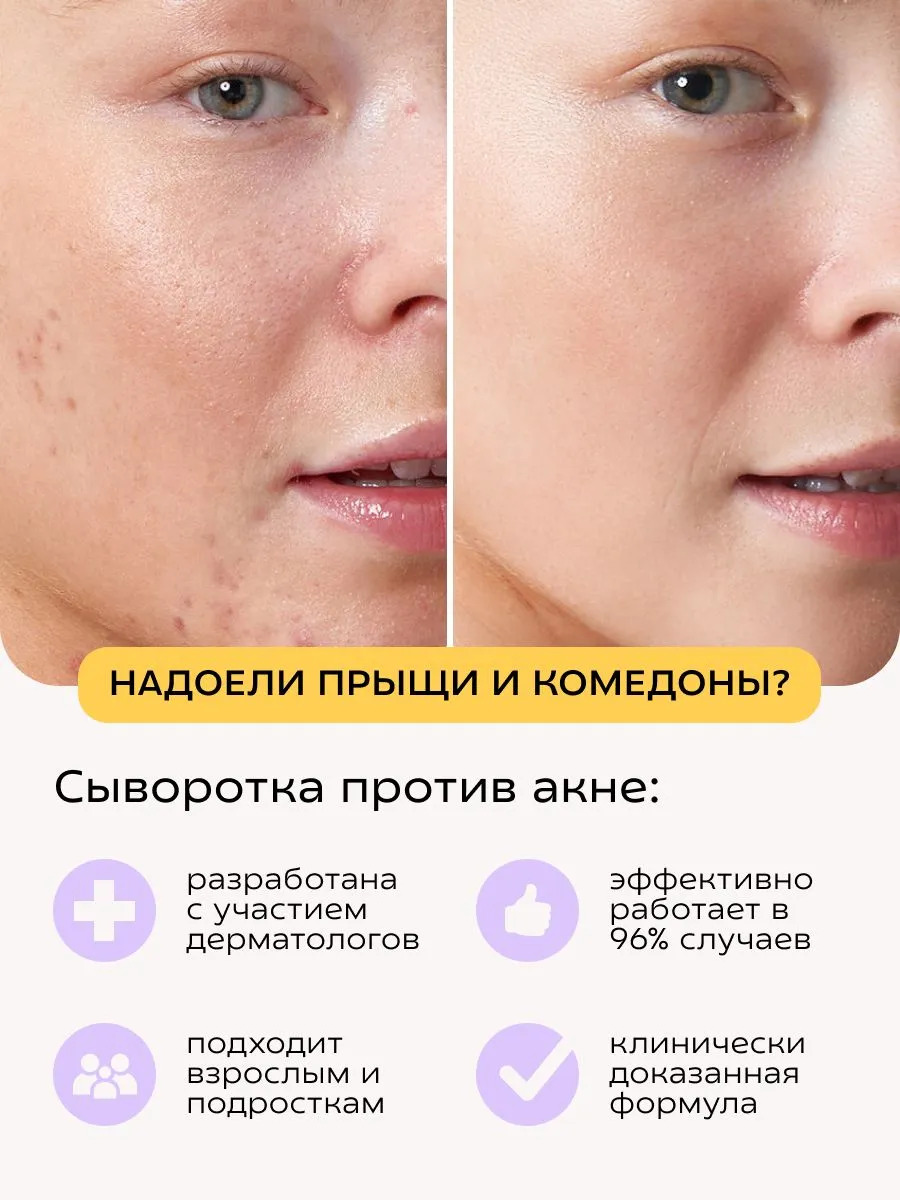Сыворотка Краснополянская косметика Муцин и Ниацинамид 30 мл 2 шт. - фото 2