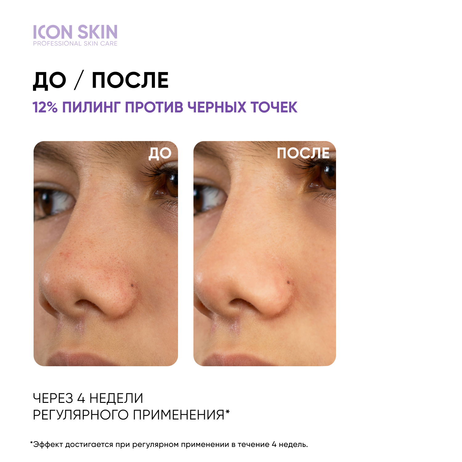 Пилинг ICON SKIN 30 мл - фото 2