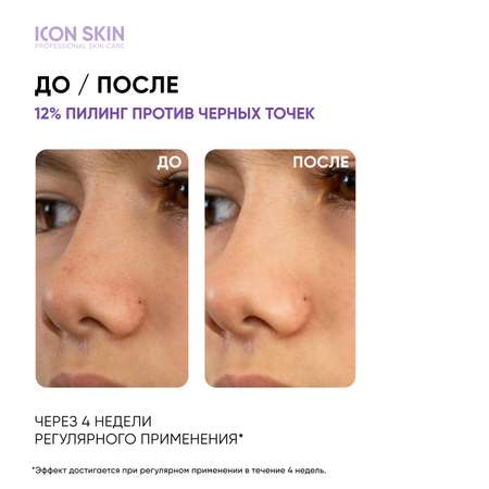 Пилинг ICON SKIN 30 мл
