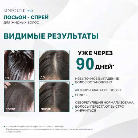 Спрей Ринфолтил 100 мл
