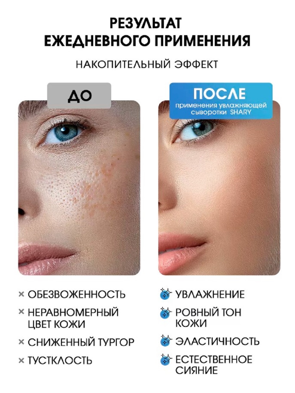 Сыворотка SHARY Perfect Skin для лица 30 мл - фото 7