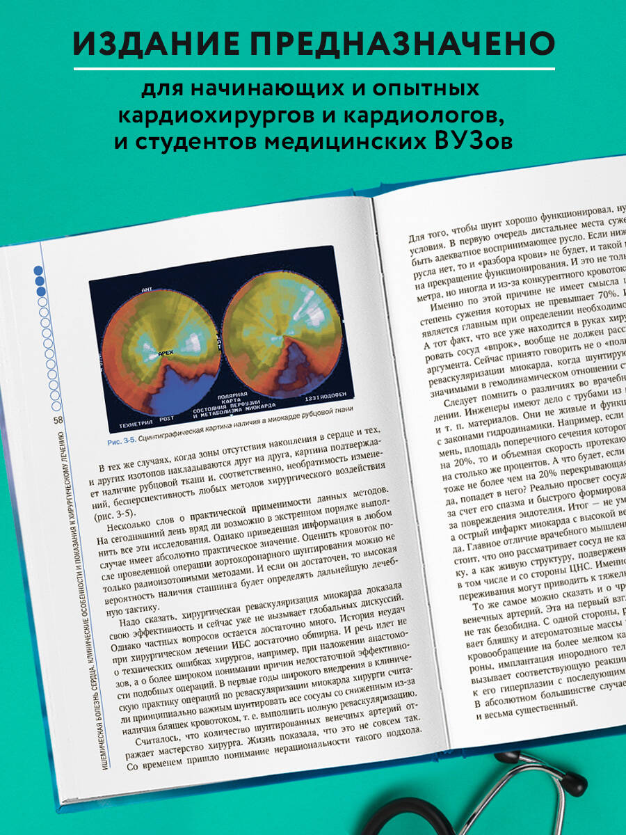 Книга Эксмо Клинические аспекты сердечно-сосудистой хирургии - фото 4