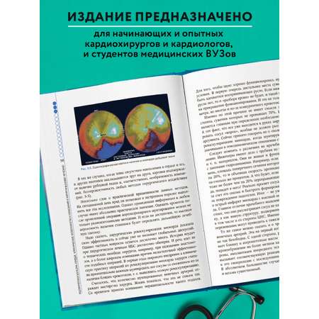 Книга Эксмо Клинические аспекты сердечно-сосудистой хирургии