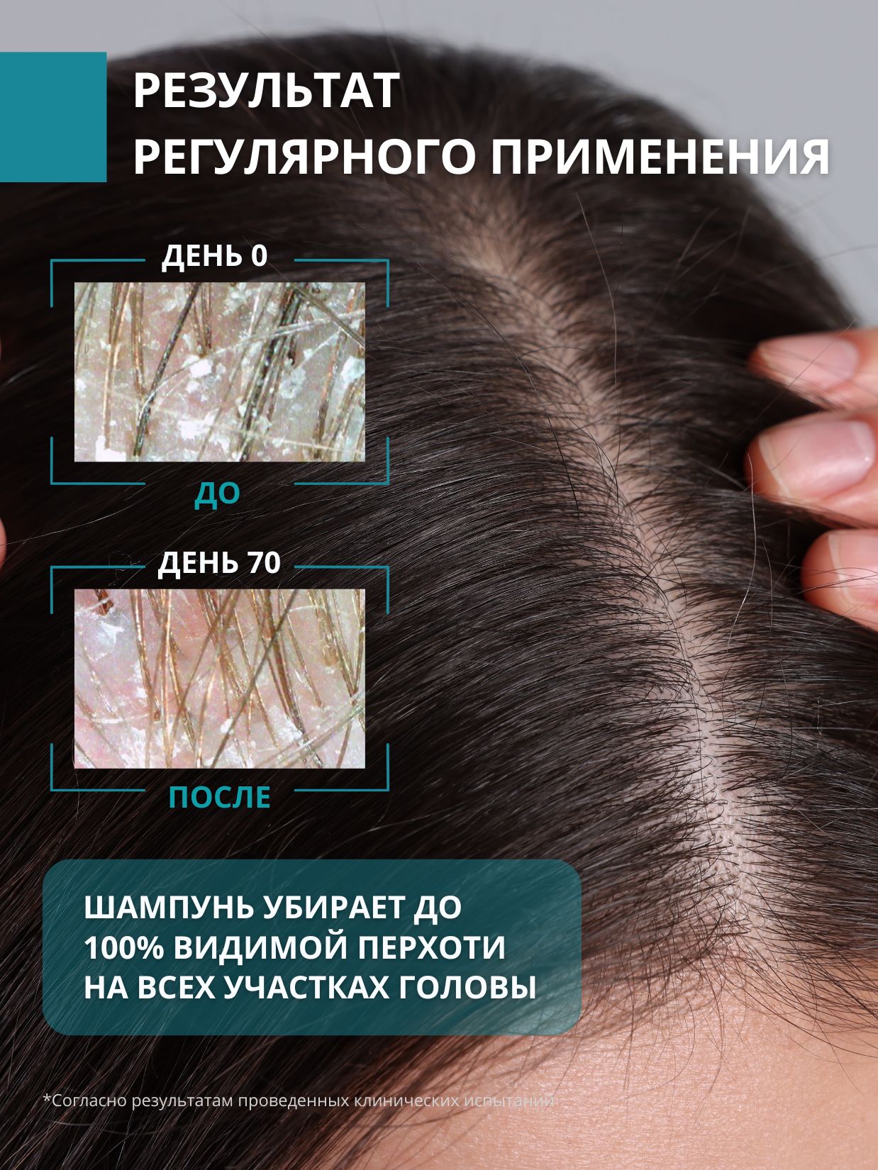 Шампунь DR. MARCUS HEILER Контроль перхоти 250 мл - фото 10
