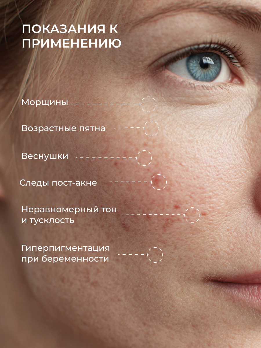 Сыворотка АКАВИЯ - фото 3