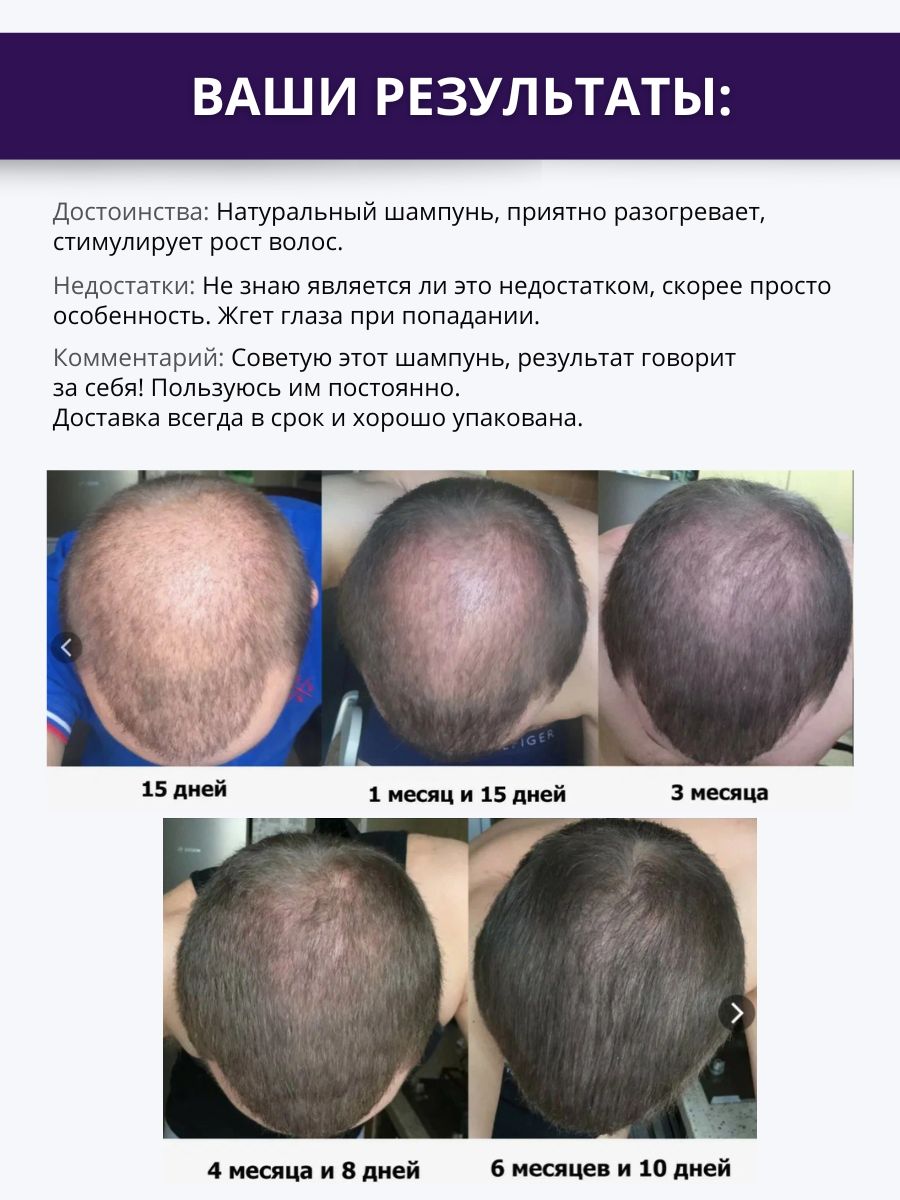 Шампунь DR. MARCUS HEILER Активатор роста волос 250 мл - фото 2