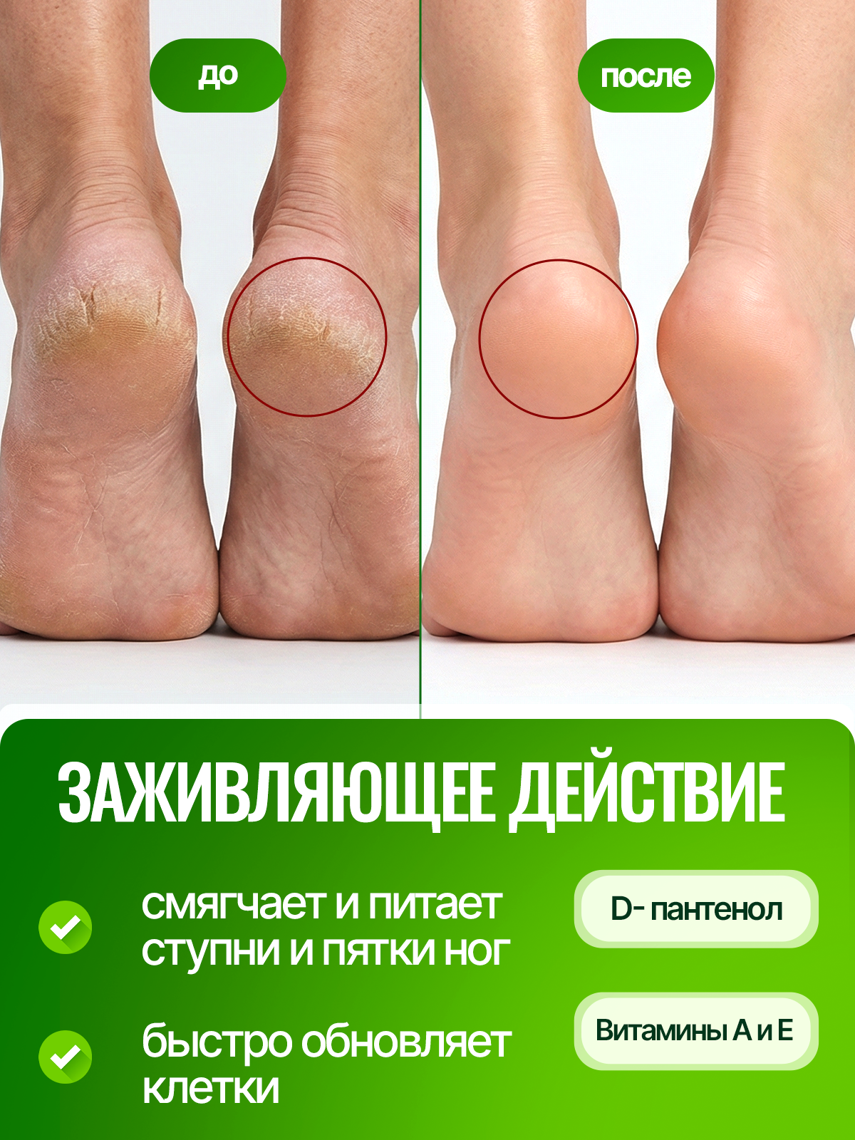 Крем Green Leaf Formula Заживляющий 100 мл - фото 3