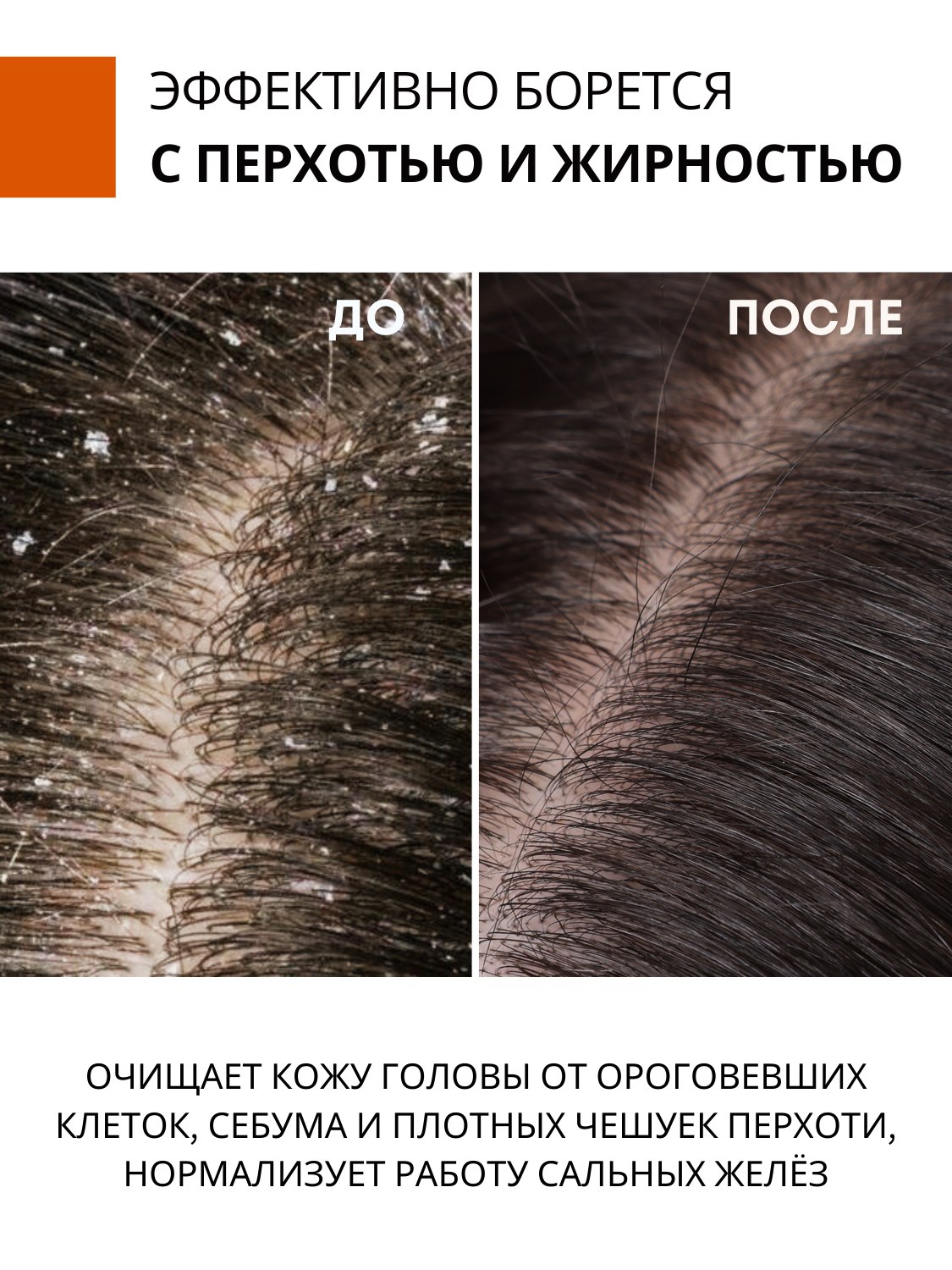 Шампунь DR. MARCUS HEILER Шампунь-пилинг от перхоти 250 мл - фото 13