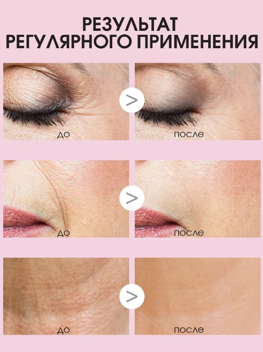 Пилинг SHARY глубоко очищающие пилинг-пады - фото 5