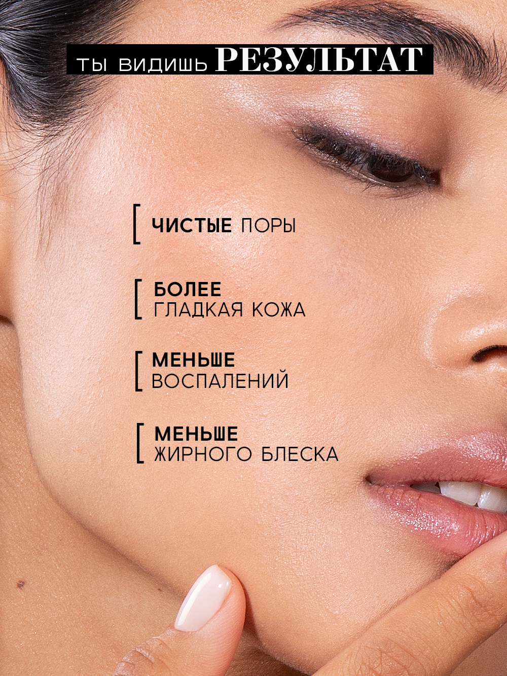 Пилинг BEAUTIFIC ACNE KILLA 30 мл - фото 5