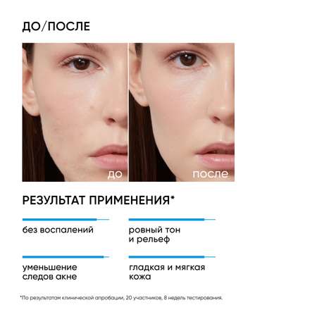 Пилинг ICON SKIN 30 мл