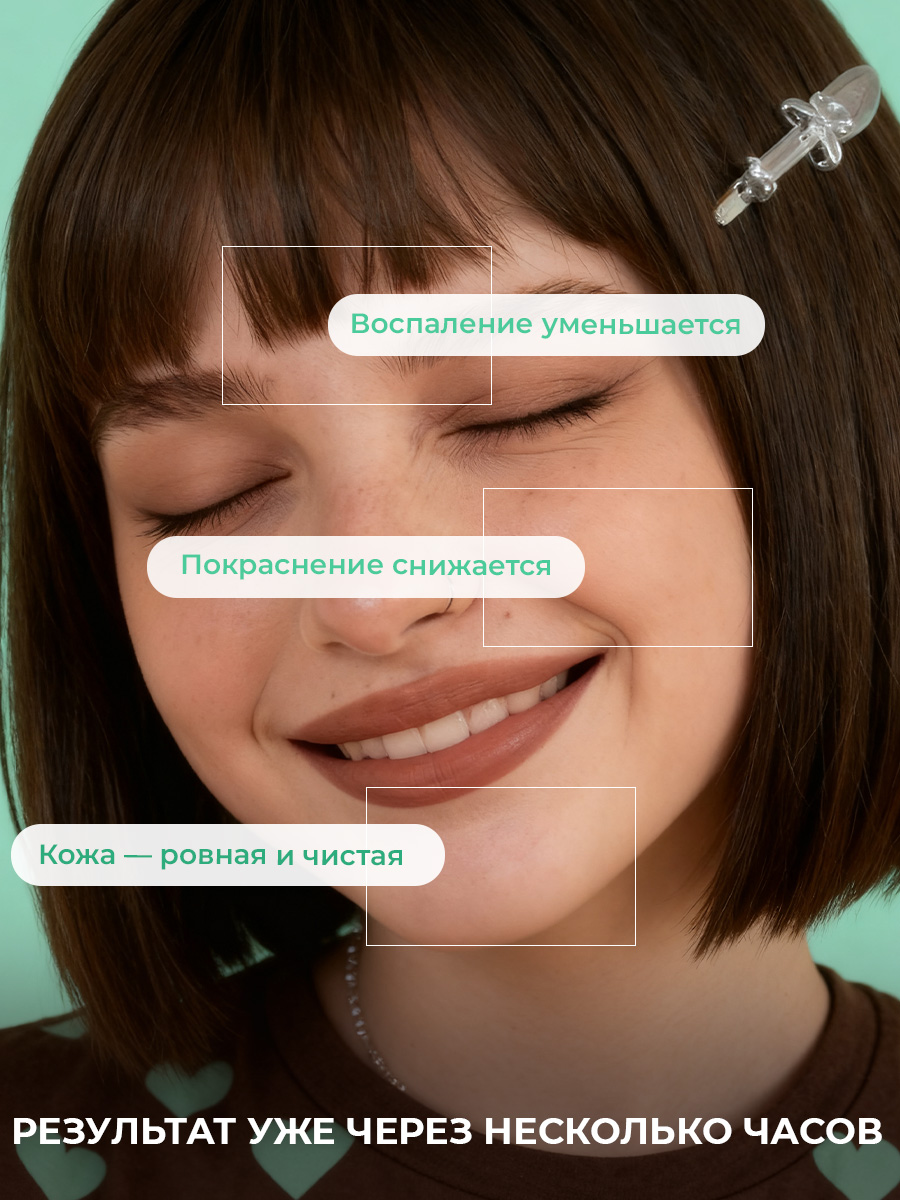 Гель EDEN Stop Acne 30 мл - фото 2