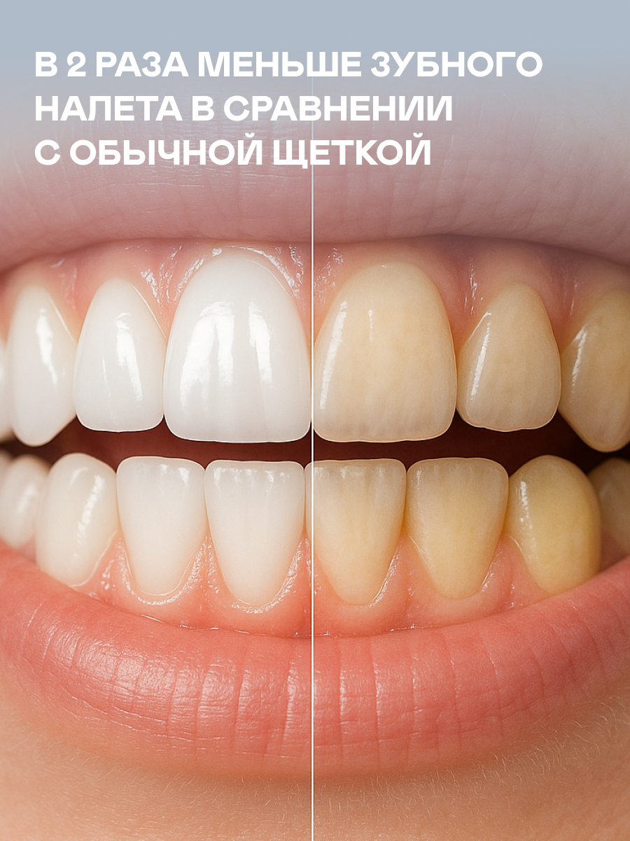 Зубная щетка электрическая GARLYN 1 шт. - фото 3