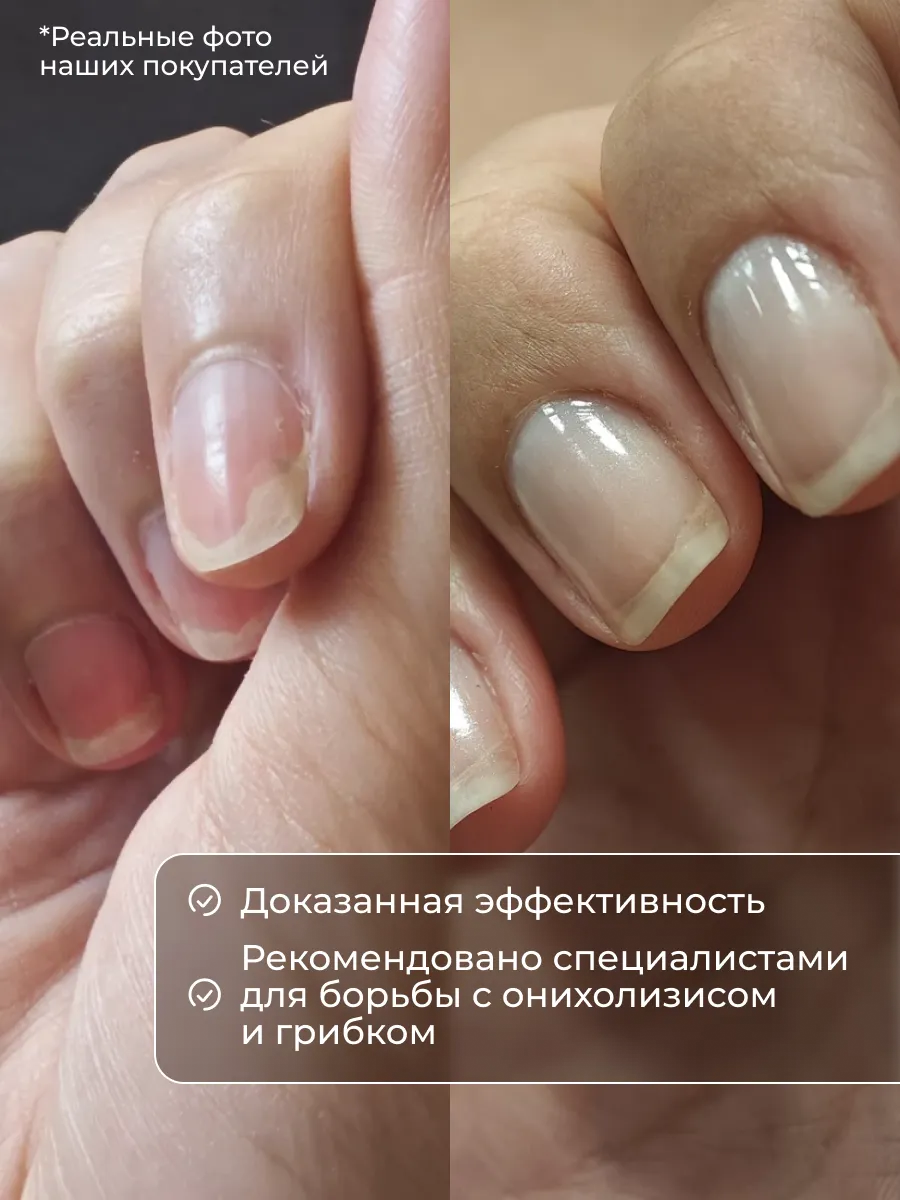 Био масло для кутикулы Qtix экстракт монарды и зелёный чай - фото 6