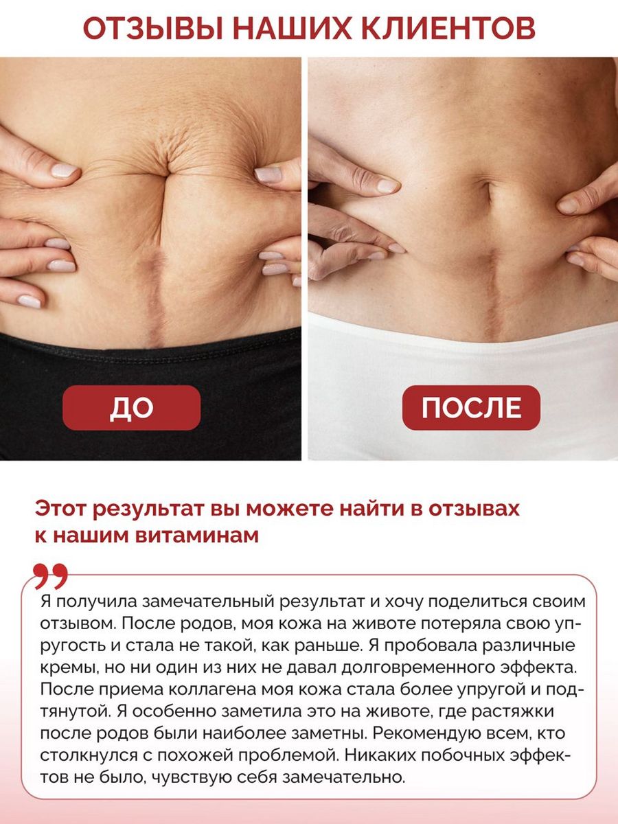 Коллаген витамин С в капсулах BIOTTE с Биоперином для волос ногтей кожи суставов 120 капсул - фото 2