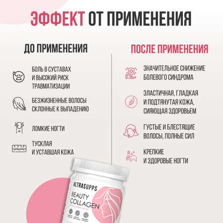 Коллаген Бьюти ULTRASUPPS 150 г для красоты кожи волос и ногтей