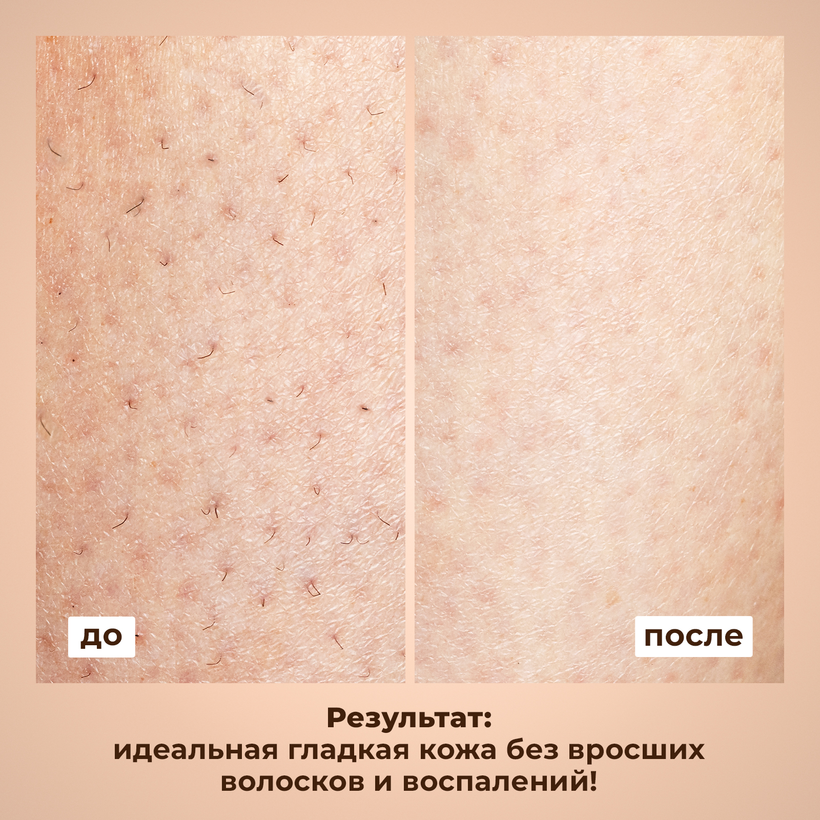 Крем NUZHNOE 200 мл 1 шт. - фото 2