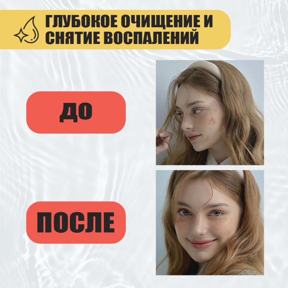 Тоник EDEN Stop Acne 150 мл - фото 3
