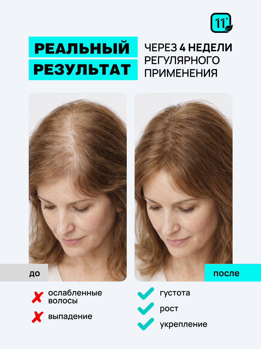 Лосьон 11i professional . Комплекс капиксил 10% 30 мл 1 шт. - фото 7