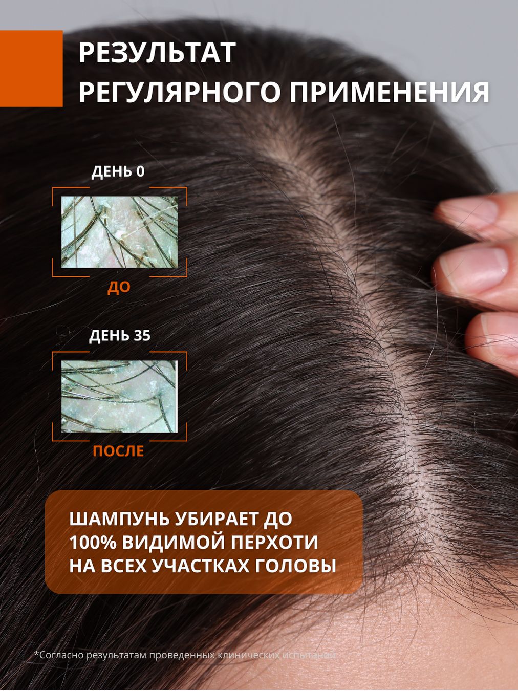 Шампунь DR. MARCUS HEILER Шампунь-пилинг от перхоти 250 мл - фото 8