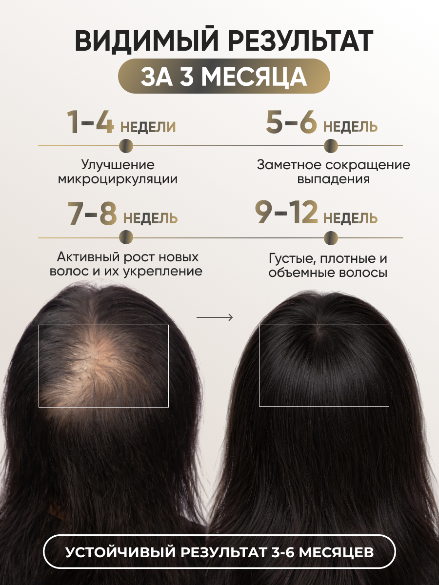 Лосьон Ринфолтил 100 мл - фото 3