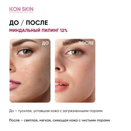 Пилинг ICON SKIN 30 мл