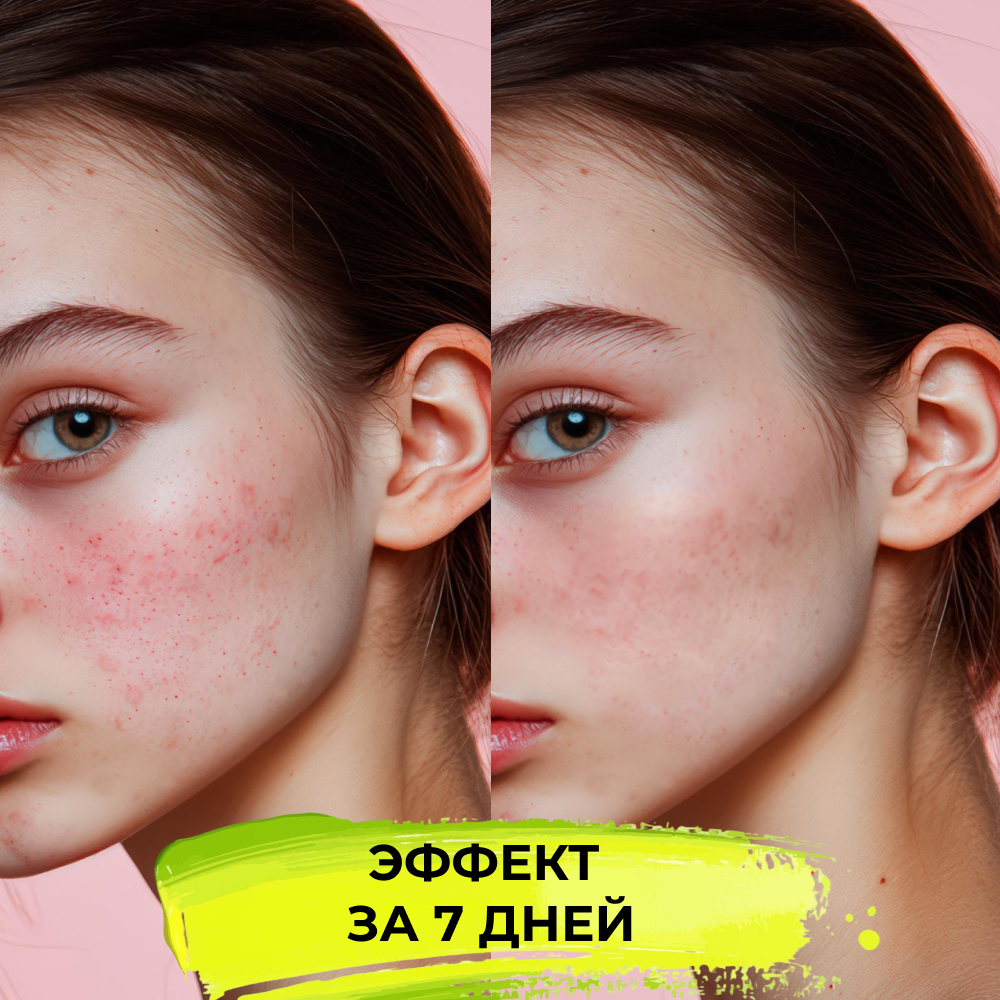 Крем Siberina 50 мл - фото 7