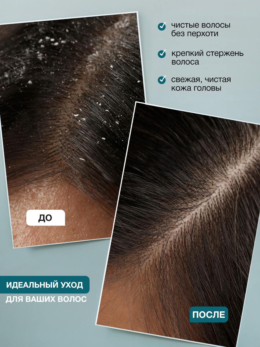 Пилинг Tashe Professional 300 мл - фото 3