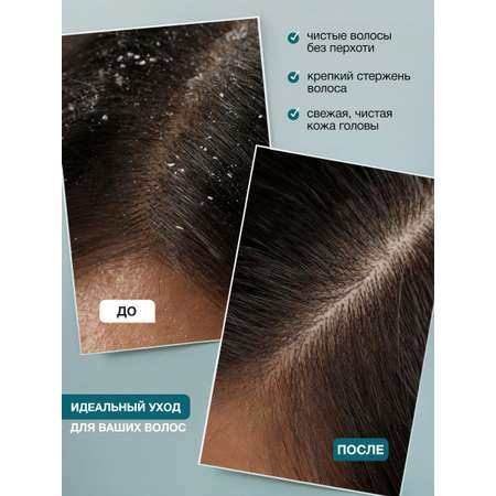 Пилинг Tashe Professional 300 мл