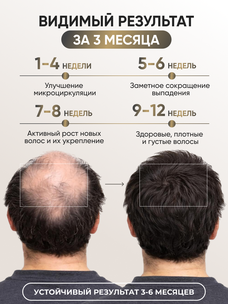 Лосьон Ринфолтил 100 мл - фото 3