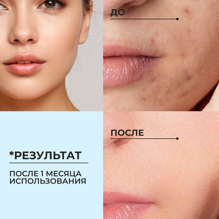 Гель Apich 150 мл