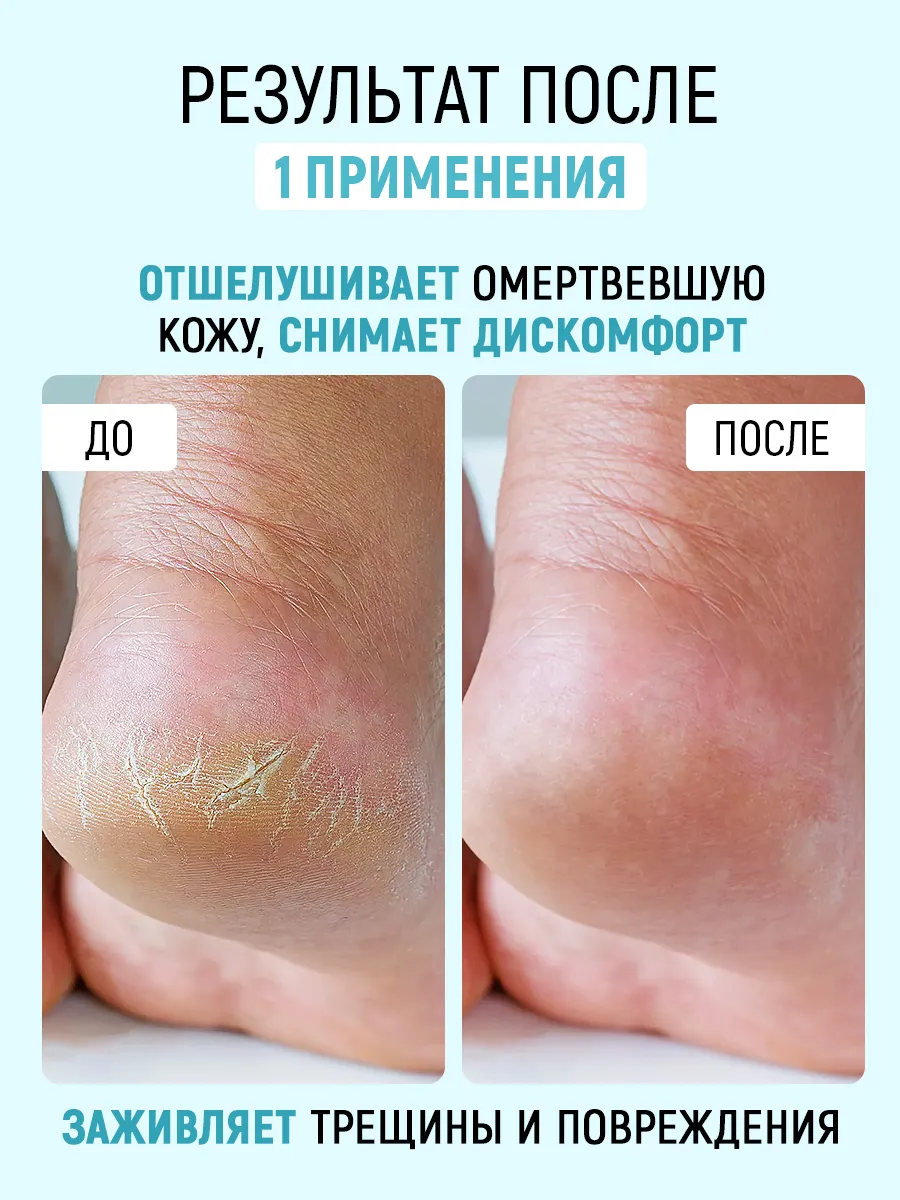 Набор CORIMO педикюр - фото 6