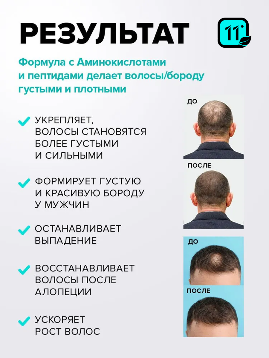 Лосьон 11i professional 50 мл 1 шт. - фото 2