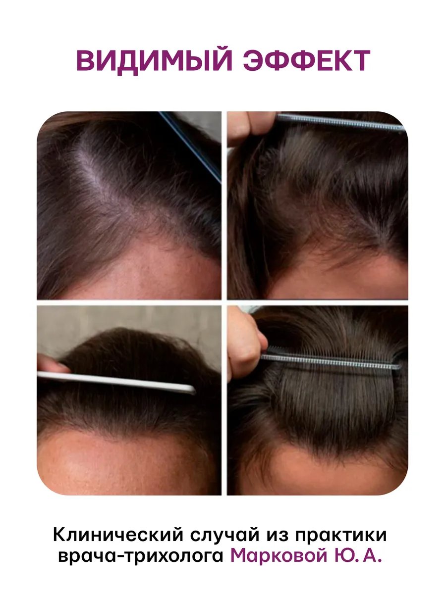 Сыворотка Селенцин 100 мл 1 шт. - фото 9