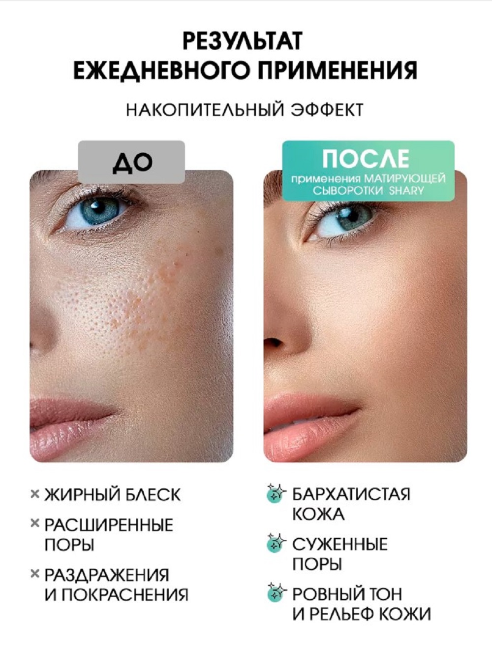 Сыворотка SHARY сыворотка себорегулирующая 30 мл - фото 4