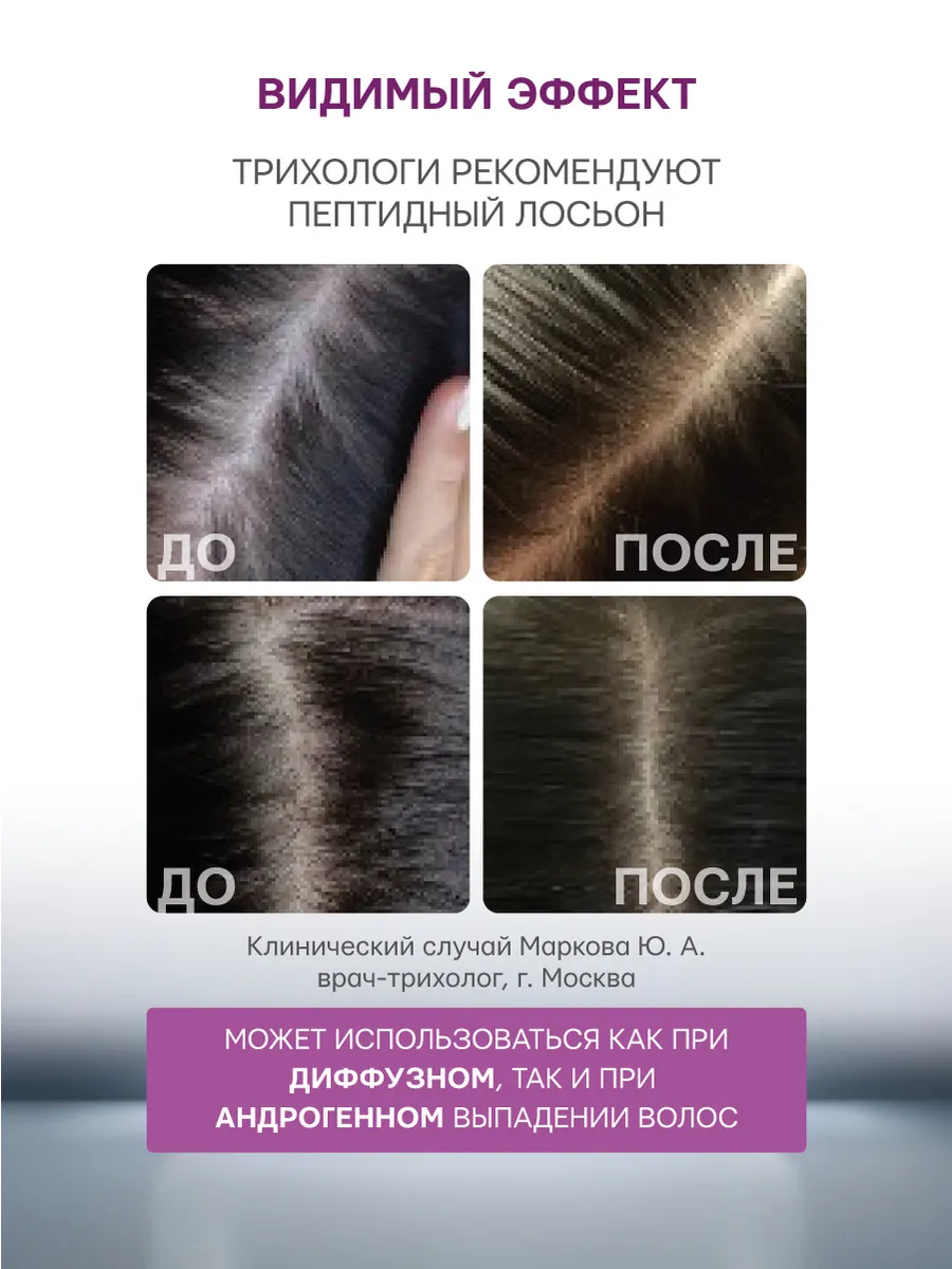 Лосьон Селенцин 75 мл 1 шт. - фото 7