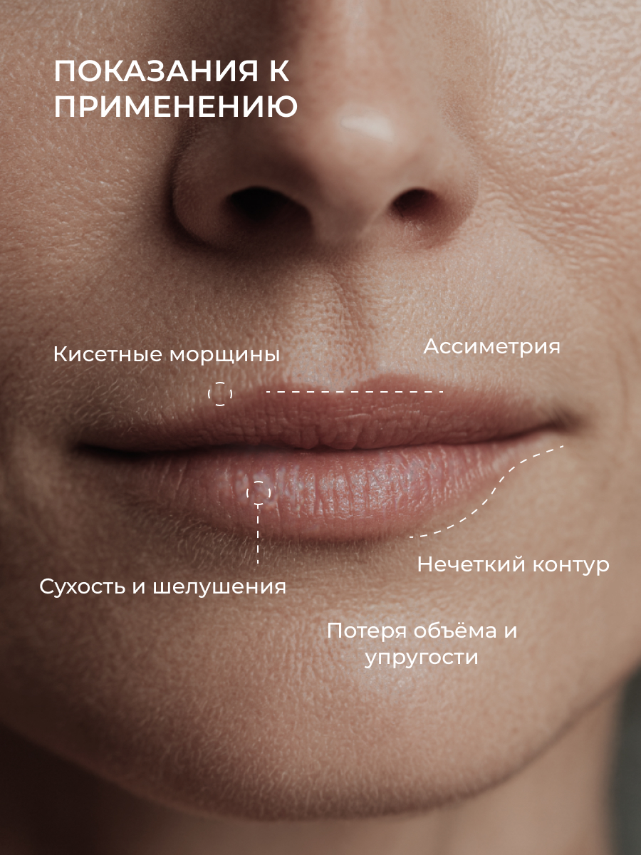 Сыворотка АКАВИЯ Для увеличения объема губ - фото 3