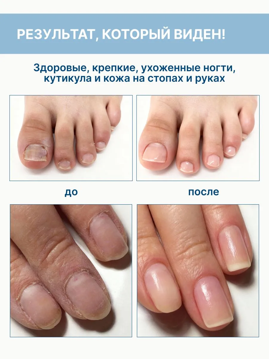 Регенерирующая Apich Сыворотка для ногтей - фото 3