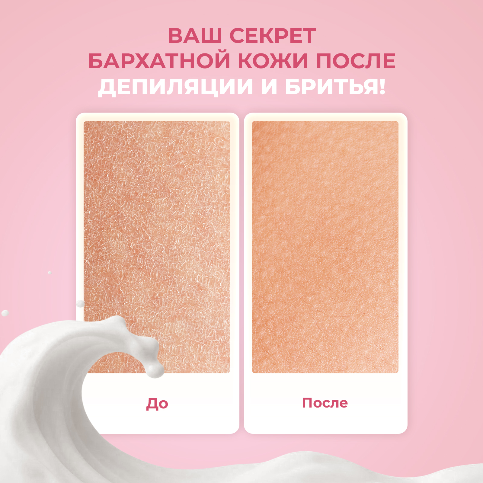 Крем-йогурт от раздражения YesMix после депиляции 200 мл - фото 2