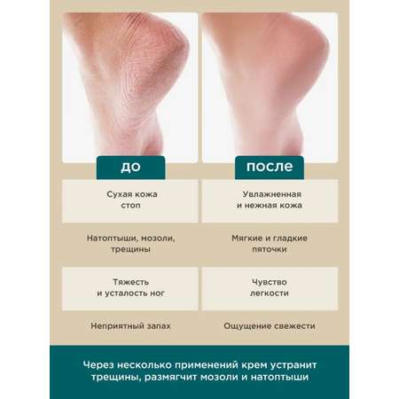 Крем PERFECT4U с охлаждающим действием 100 мл