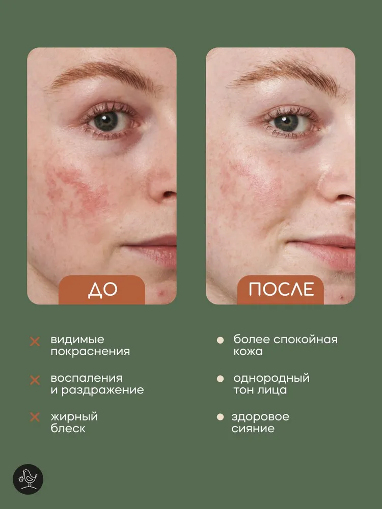 Гидролат Краснополянская косметика Липа 100 мл 1 шт. - фото 3