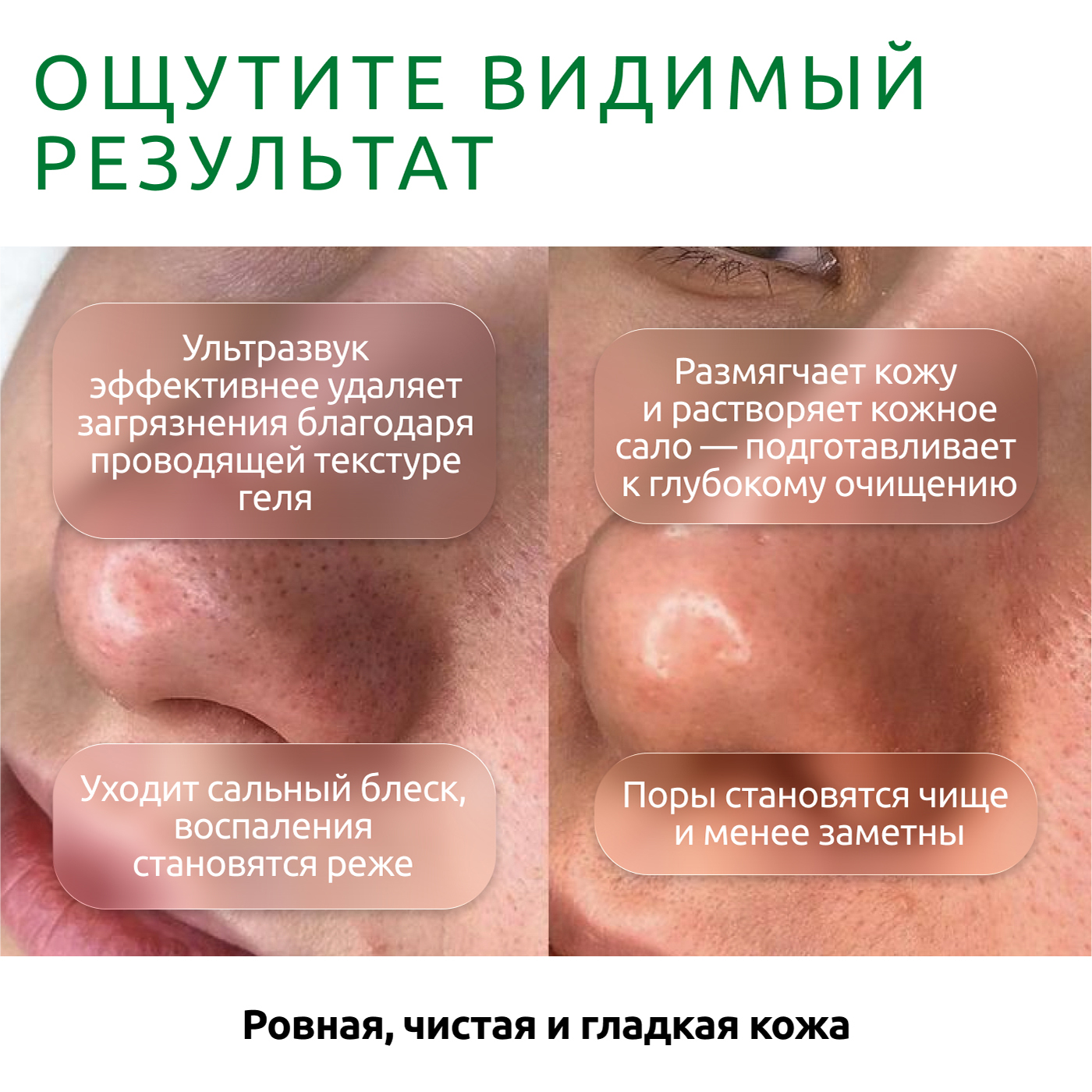 Гель ReadySkin Care Ultraclean Gel - фото 5