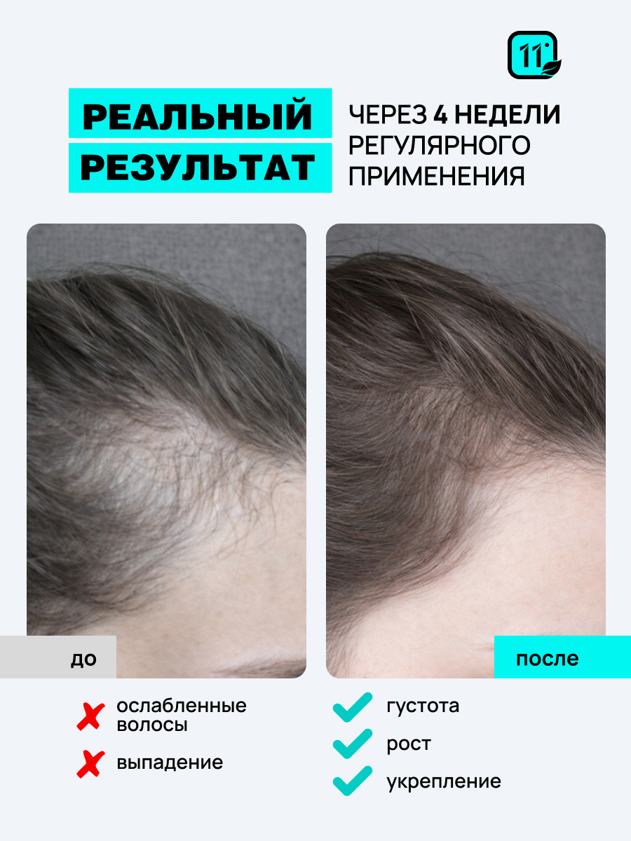 Лосьон 11i professional . Комплекс капиксил 10% 30 мл 1 шт. - фото 4